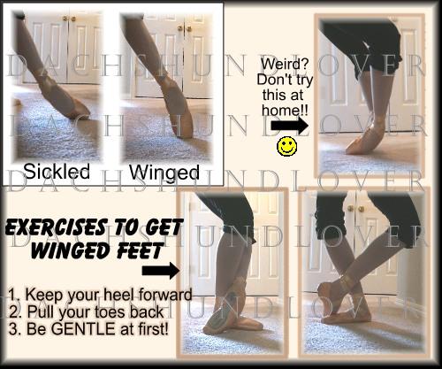 sickled feet ballet